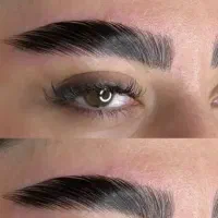 لیفت ابرو با قیمت مناسب