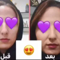 جوانه گندم|آرایشی، بهداشتی، درمانی|تهران, تهرانسر غربی|دیوار