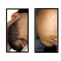 بلیط کنسرت فوری ریش