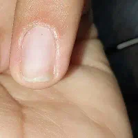 مدل کاشت ناخن