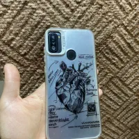 Galaxy a 11|موبایل|شهریار, بکه|دیوار