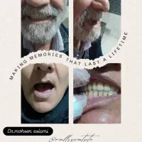 دندانپزشکی،دندانسازی|خدمات آرایشگری و زیبایی|دشتابی, |دیوار