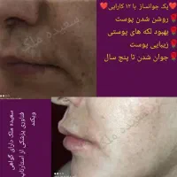 پک جوانساز بیست کاره سعیده ملک|آرایشی، بهداشتی، درمانی|بافق, |دیوار