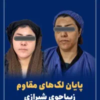 لیزرco2 فرکشنال جوانساز درمان لک‌ تک جلسه درکلینیک