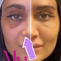 دستیار پزشک زیبایی