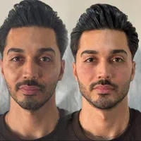 تزریق ژل لب،گونه،زاویه فک ،چانه،بوتاکس و فیلر بدن|خدمات آرایشگری و زیبایی|کرج, فاز ۱ مهرشهر|دیوار