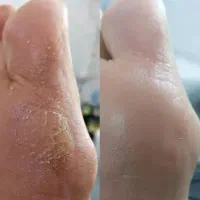 پدبکوروکفسابی|خدمات آرایشگری و زیبایی|قم, فرهنگیان و شهربانی|دیوار