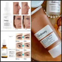 تخفیف فوق ویژه