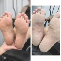 پدیکور درمانی در تخفیف ویژه