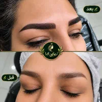 میکروبلیدینگ ابرو /فقط وفقط هزینه مواد