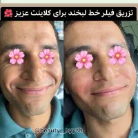 آموزش صفر تاصد پیشرفته ژل و بوتاکس|خدمات آموزشی|اندیمشک, |دیوار