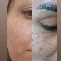 جشنواره تخفیفات پاییزه بهترین برای زیباجویان