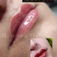 فیبروز.میکروبلیدینگ.شیدینگ لب در سربیشه|خدمات آرایشگری و زیبایی|سربیشه, |دیوار