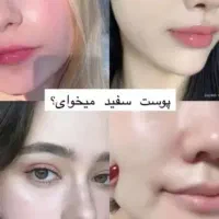 فرمول سفید کننده خیلی قوی صد در صد تضمینی