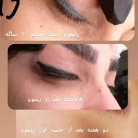 مرکز تخصصی ریموو تتو.شیدینگ لب.میکرو.آموزش|خدمات آرایشگری و زیبایی|گرگان, |دیوار