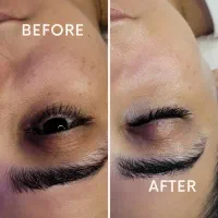 فیشیال تخصصی (پیراپزشک)