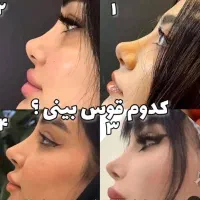 اقساط 24 ماهه جراحی ها فقط با جراحان پلاستیک درجه1|خدمات آرایشگری و زیبایی|تهران, محمودیه|دیوار