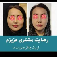 صورت زیبا بدون دارو