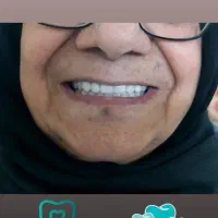 خدمات کشیدن دندان و ساخت دندان مصنوعی