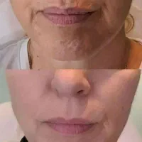 کرم بیوممتیک|آرایشی، بهداشتی، درمانی|تهران, دولاب|دیوار