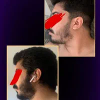 باریش صورتتو جذاب کن