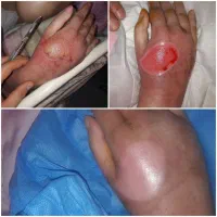 کارشناس تخصصی زخم و استوما|خدمات آرایشگری و زیبایی|قم, زنبیل آباد|دیوار