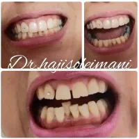مدل دندانپزشکی|خدمات آرایشگری و زیبایی|تهران, درختی|دیوار
