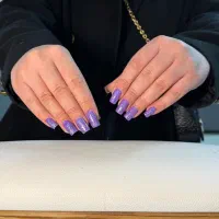 کاشت فقط هزینه ی مواد فقط امروز