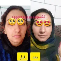محصولات گیاهی چاقی لاغری و پوست مو