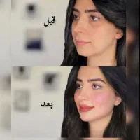 پک ده سیسی فیلر صورت 6/900ت کره ای اصل