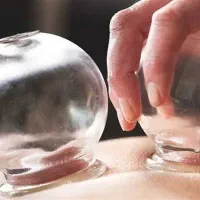 راهنمای حجامت