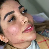 کلینیک ژل لب روسی و بوتاکس و آنزیم فیلر مطب پزشک