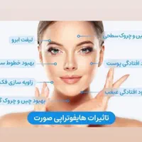 مدل برای هایفوتراپی فقط باقیمت استثنایی 950تومان|خدمات آرایشگری و زیبایی|تبریز, |دیوار