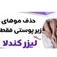 اپراتور لیزر