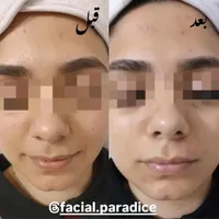 آموزش و پاکسازی و فیشیال تخصصی پوست|خدمات آرایشگری و زیبایی|مشهد, فارغ التحصیلان|دیوار