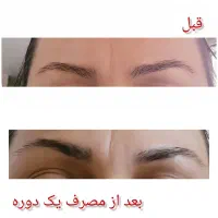 راه طبیعی رشد ابرو و مژه|آرایشی، بهداشتی، درمانی|تربت جام, امام|دیوار