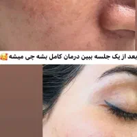 درمان ناهنجاری پوست و آموزش خاویار تراپی|خدمات آرایشگری و زیبایی|شیراز, باهنر|دیوار