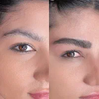 میکروبلیدینگ و فیبروز نچرال و مویی