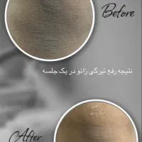 درمان پوست باتخفیف بلک فرایدی/پوست کره‌ای/کاموفلاژ|خدمات آرایشگری و زیبایی|پاکدشت, پاکدشت (مامازند)|دیوار