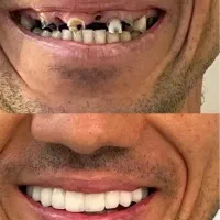 خدمات زیبایی و درمانی دندان