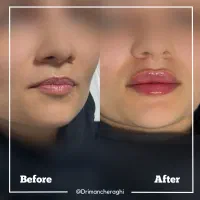 جشنواره پاییزی تخفیفات زیبایی توسط پزشک|خدمات آرایشگری و زیبایی|کرمانشاه, |دیوار
