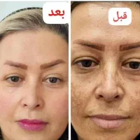 مشاور پوست و مو|آرایشی، بهداشتی، درمانی|قم, وادی السلام|دیوار