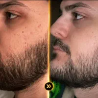 تیغ نزن در نمیاد