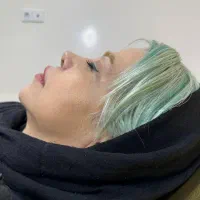 عمل بینی اقساطی فقط با ماهی ۳ تومن استخوانی وگوشتی