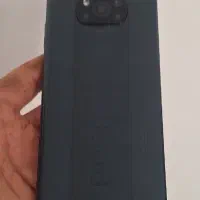 شیائومی poco x3