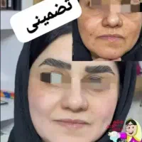 فرمول کرم معجزه،فرمول کرم وی آی پی|آرایشی، بهداشتی، درمانی|شادگان, |دیوار