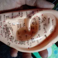 اموزش طب سوزنی|خدمات آموزشی|اصفهان, آزادگان|دیوار