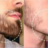 کاشت ممنوع ممنوع