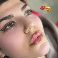 تزریق ژل و بوتاکس جوانسازی|خدمات آرایشگری و زیبایی|تهران, عبدل‌آباد|دیوار