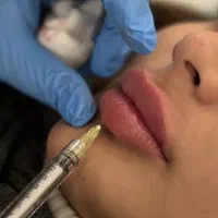 کلینیک زیبایی و لیزر موهای زائد